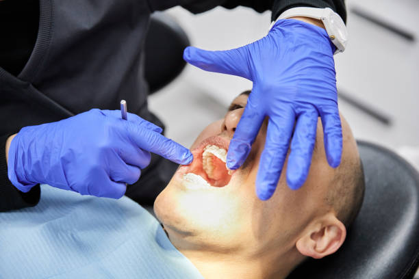 Best Chipped Tooth Repair Near Me  in Steele, MO